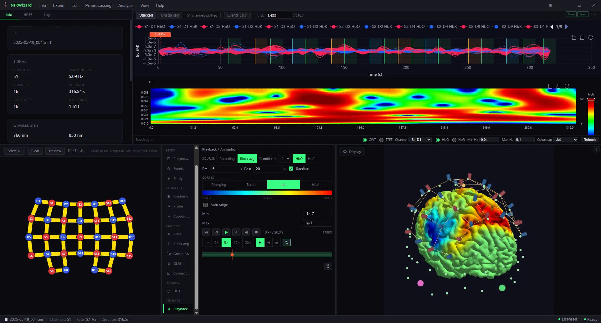 The NIRWizard interface showing a recording's info panel, stacked fNIRS signal traces, a wavelet spectrogram, an optode montage, block-average playback controls and a 3D cortical activation map