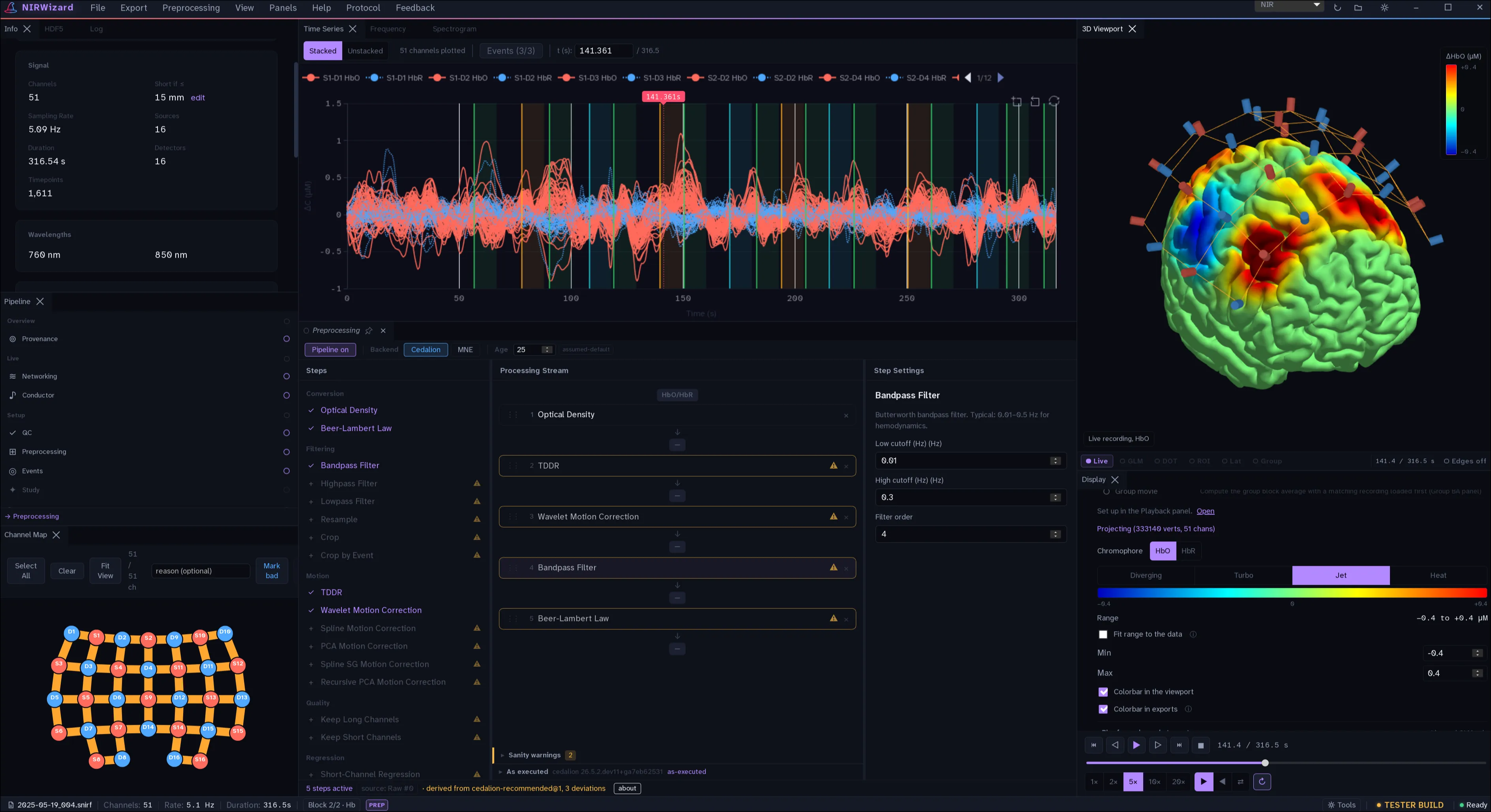 NIRWizard with a 51-channel recording open: stacked HbO and HbR time series with event bands, a preprocessing pipeline of optical density, TDDR, wavelet motion correction, band-pass filter and Beer–Lambert law, the optode channel map, and a 3D cortical HbO activation map