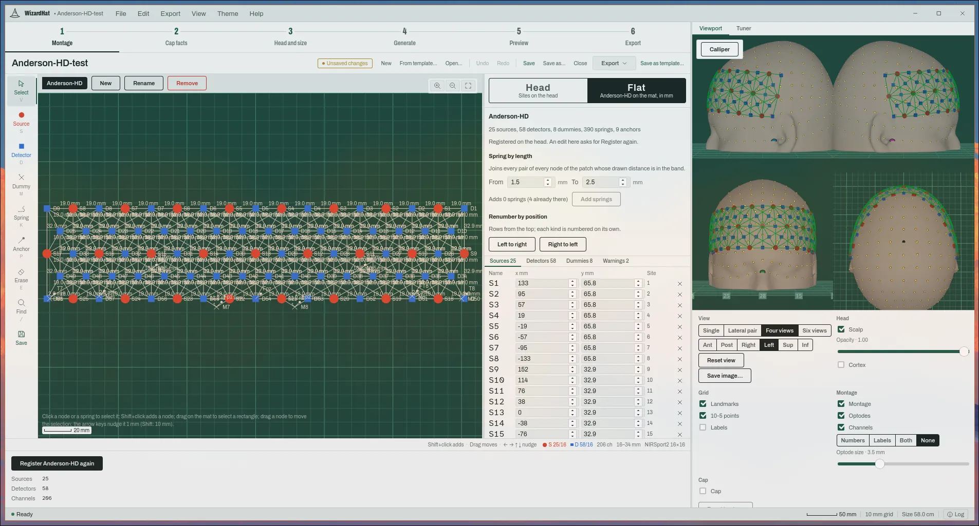 Flat mode: a patch of nodes and springs on the cutting mat, its source table, and the registered montage on the head