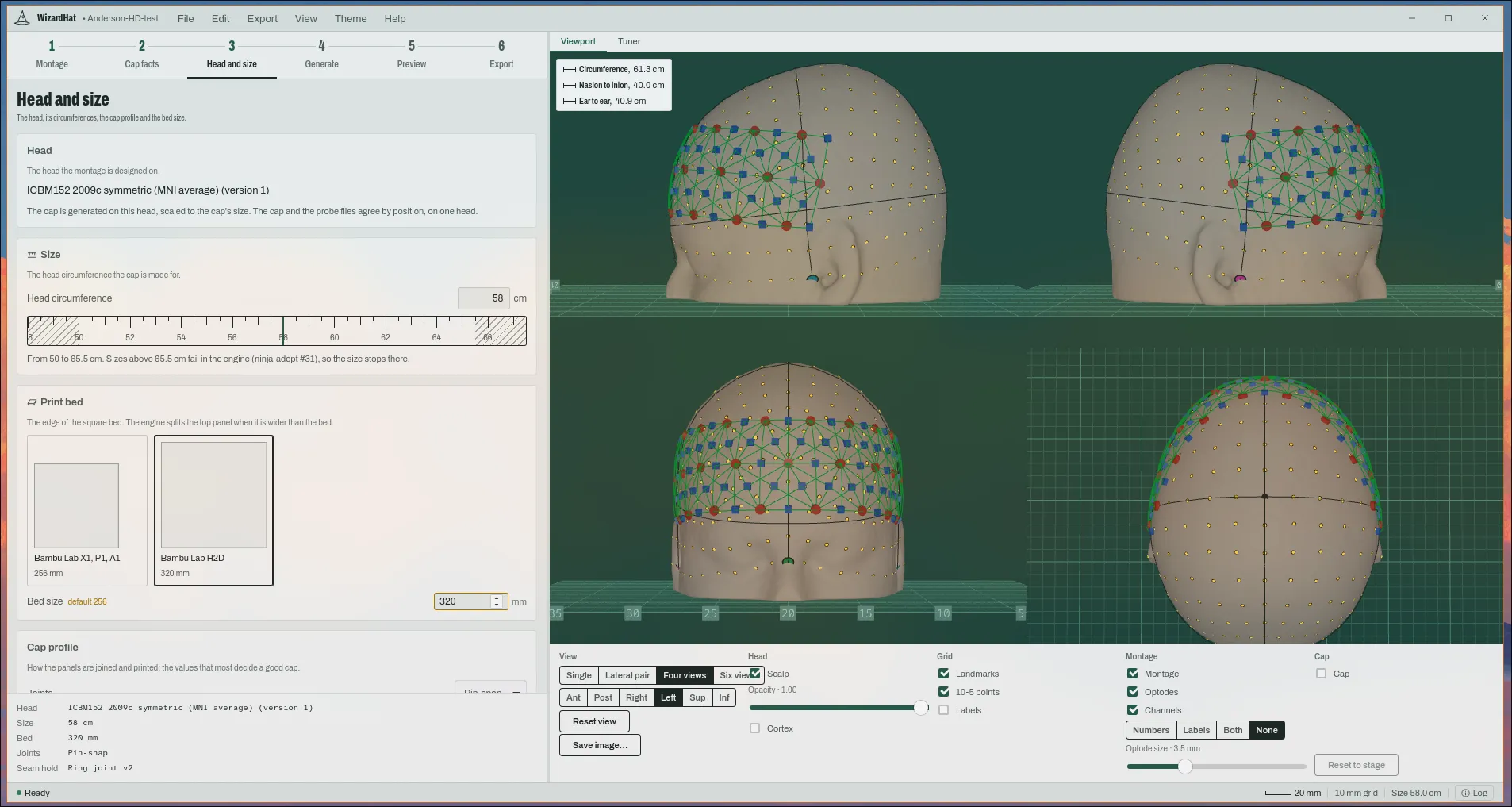 The Head and size stage: the design head, a 58 cm circumference, a 320 mm bed and the cap profile