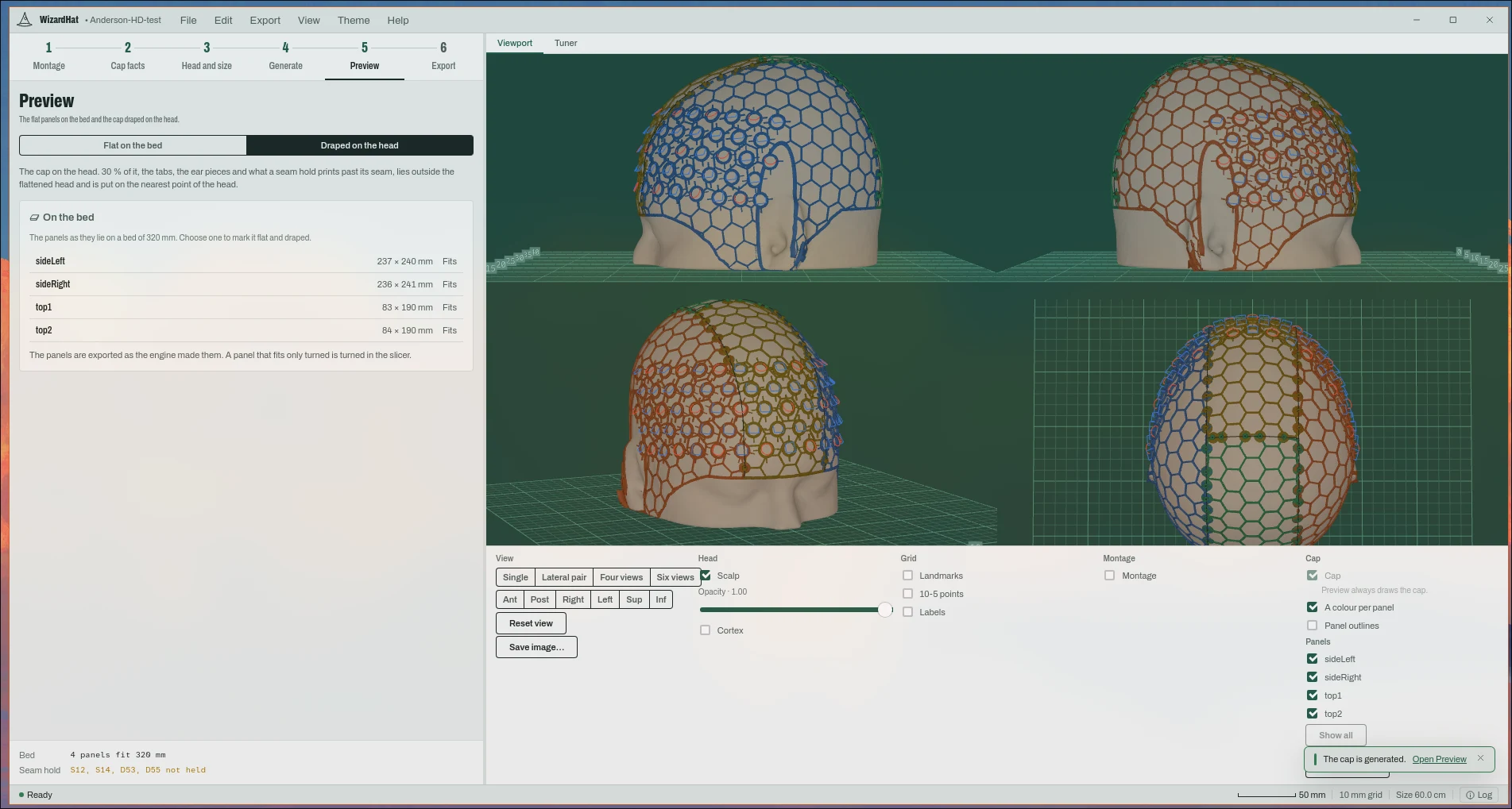 The Preview stage, draped: the cap lattice on the design head.