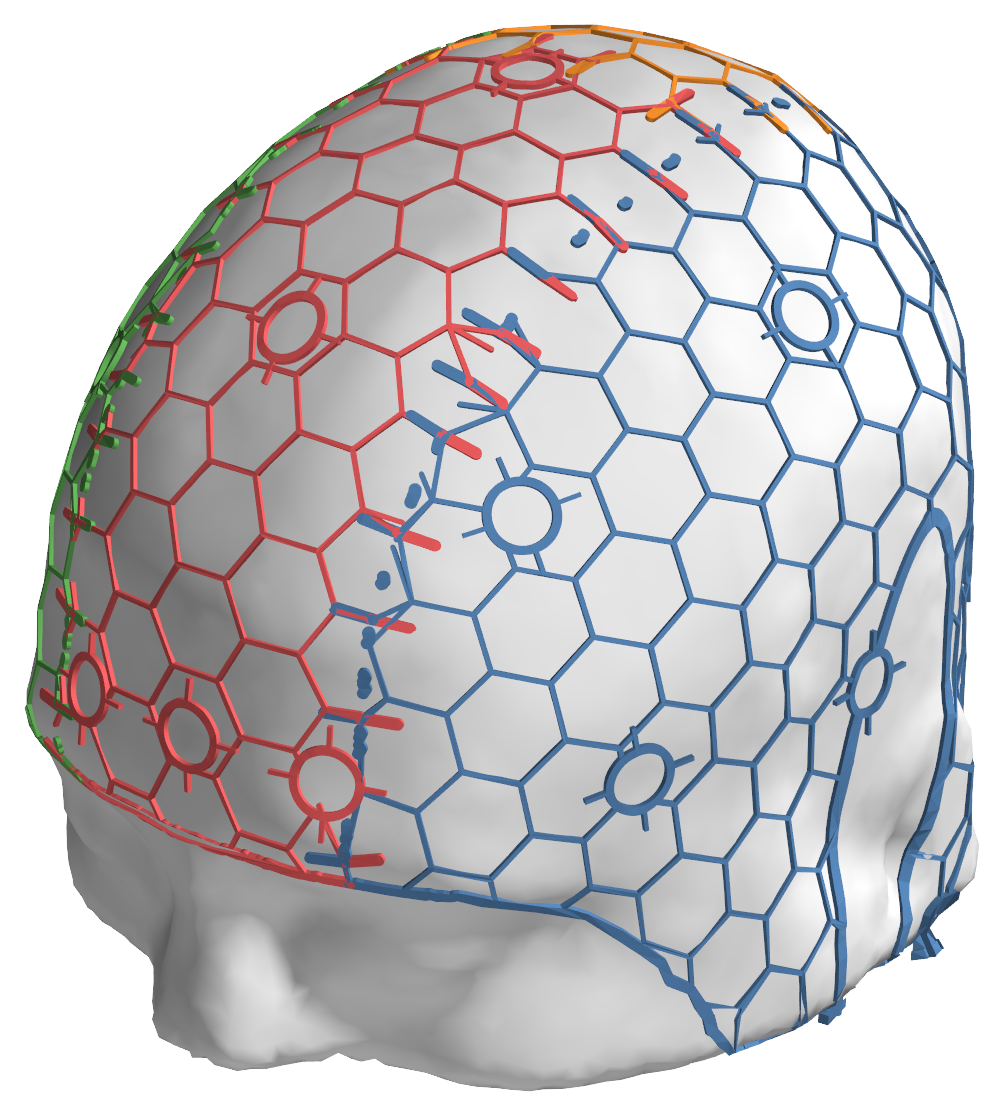 The matching validation cap on the head.
