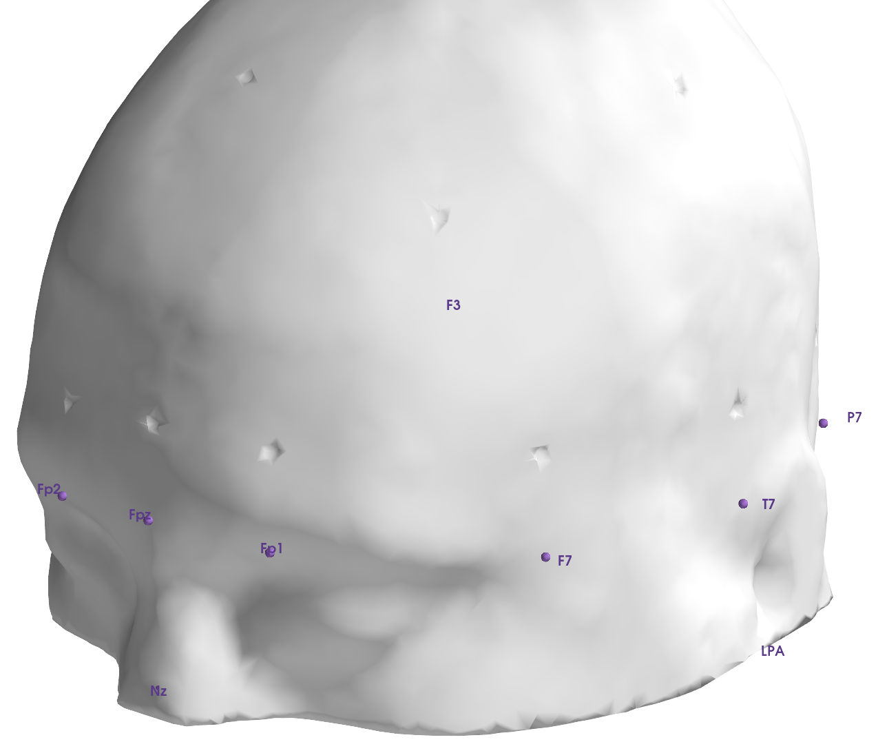 The printable validation head with dimples at the 10-20 positions.
